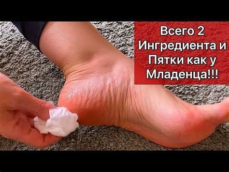 Всего 2 Ингредиента и Пятки как у Младенца!/Рецепт - YouTube | 2 ...
