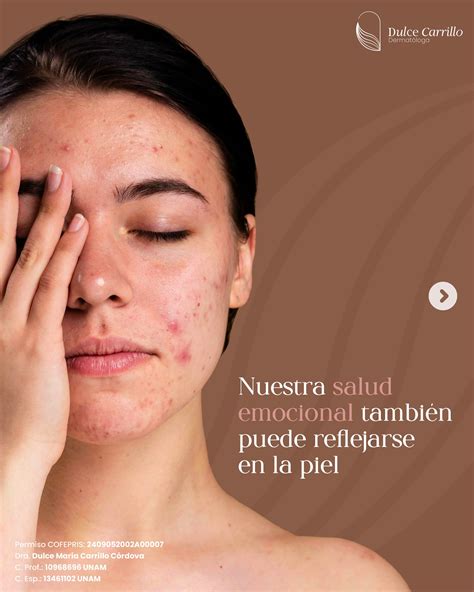 Dra. Dulce Carrillo | Mexico City