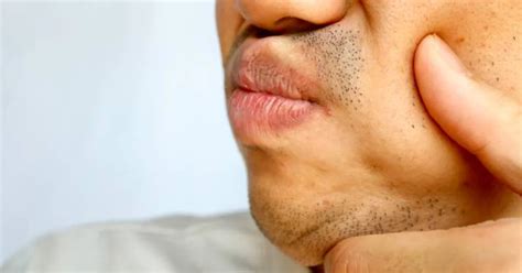 understanding swelling   roof   mouth  quick guide