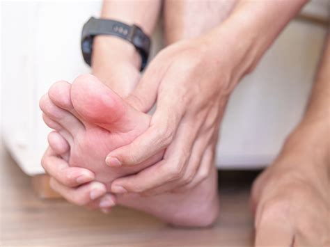 Blasen und Blasenpflaster: Wie behandelt man sie richtig und sorgt