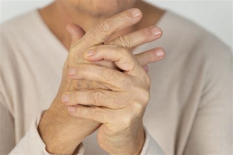 Rheumatoid Arthritis Patients Likely to Experience Joint Swelling in