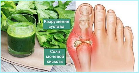 4 мощных домашних средства, которые эффективно избавят от мочевой ...