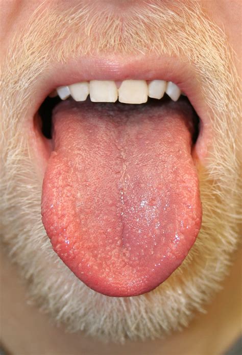 What Happens When You Put Salt Under Your Tongue