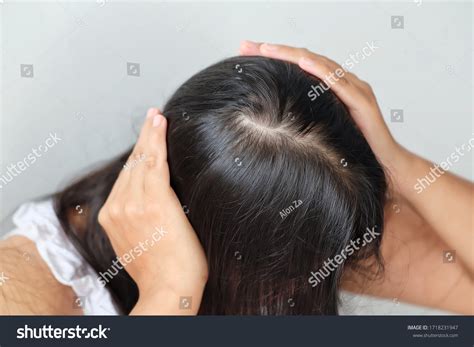 Young Woman Thin Hair Problemcloseup Stock Photo 1718231947 | Shutterstock