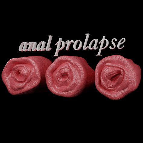 SmutBase • anal prolapse V2