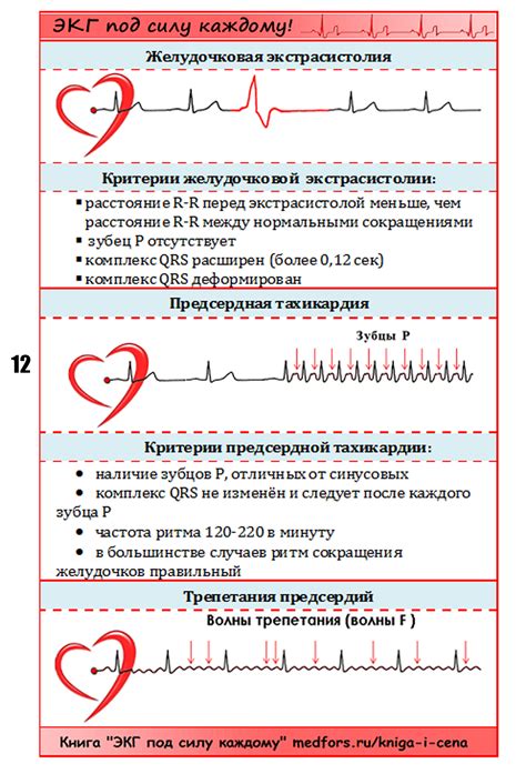 ЭКГ под силу каждому. Шпора 12.jpg | MEDFORO.RU - Медицинский форум