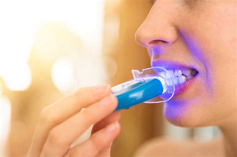 at home tooth whitening 4