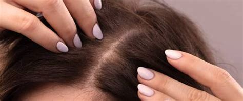 5 Hairy Solutions For The Ultimate Bald-Fighting Beauty Fix