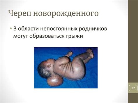 Возрастная анатомия черепа. Вариантная анатомия черепа - презентация онлайн