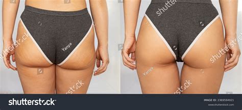 5 Shocking Reasons You're Still Growing Hair In Unwanted Places (And 3 Genius Hacks To Make It Stop)