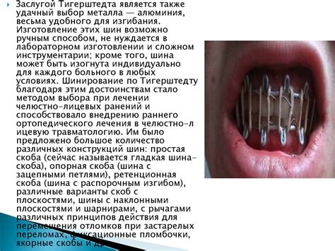Шины Тигерштеда - презентация онлайн