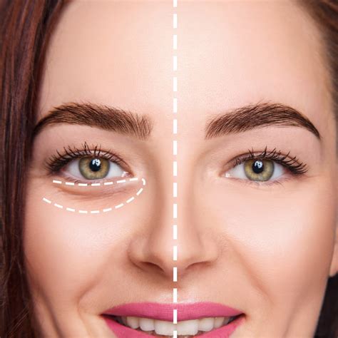 Makeup Tips For Bags Under Eyes