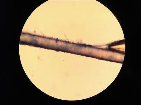 hair under microscope 7