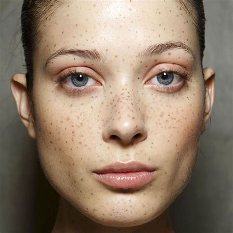 Spotted at Preen: Freckles Are the "It" New Beauty Mark | Freckles