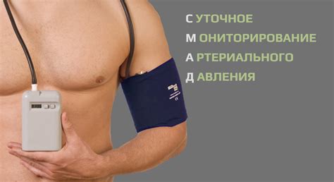 СМАД -Проведение суточного мониторирования артериального давления в ...
