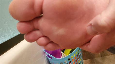 My foot is swollen, hurts, and I have this white mark under my foot : r