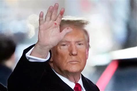 Что за странные пятна замечены на руках Трампа