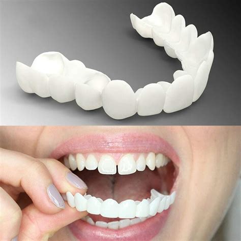 2pcs Set Upper Lower Teeth Veneers Whitening Snap On Smile | Desertcart ...