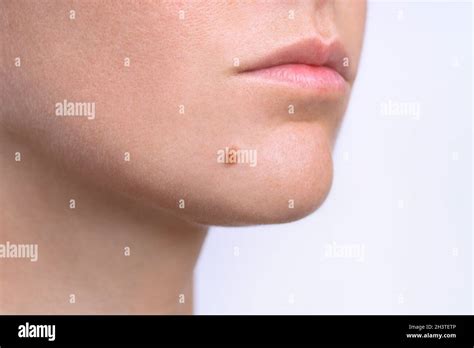 Mole On Face