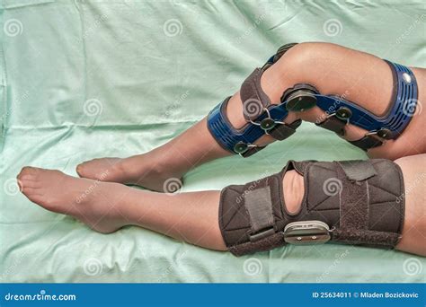 Knee braces stock image. Image of deformation, dislocation - 25634011