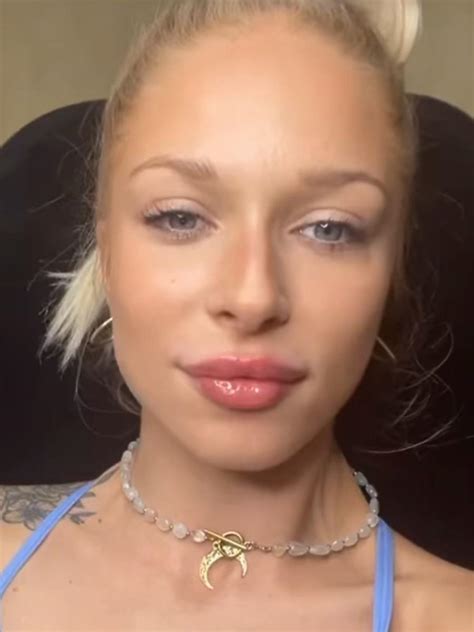 "Hotel Paradise 5": Oliwia pokazała zdjęcie po wizycie w klinice