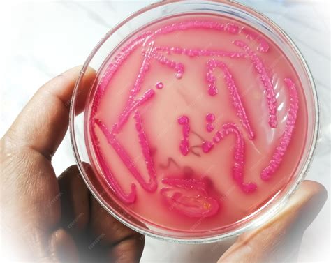 Premium Photo | Bacteria colony on culture media plate, stool culture