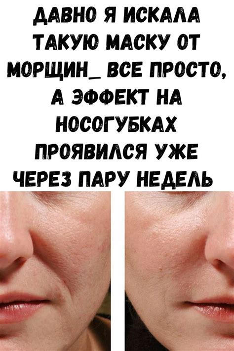Макияж | Подтяжка кожи, Худое лицо, Маски