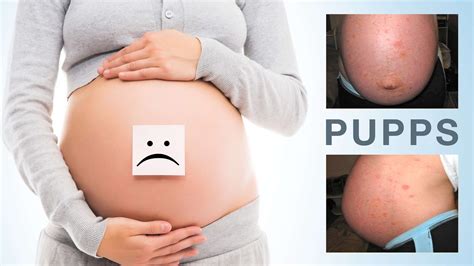 18++ What is puppp info | Build a Harmonious Family for Future