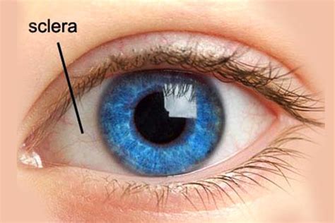 Tutoplast Sclera