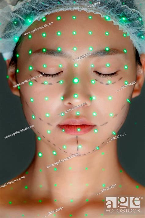 Young woman do laser cosmetic, Stock Photo, Picture And Royalty Free ...