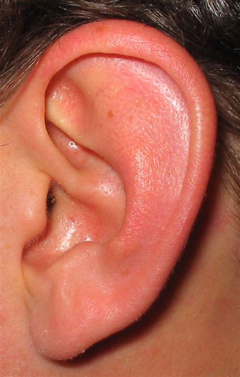 Treating Fungal Ear Infections: Effective Home Remedies