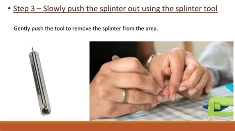 how to draw a splinter out of your finger