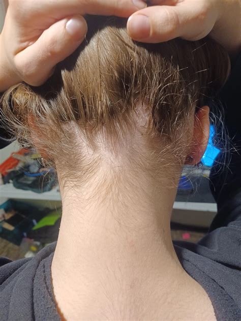 Why Is The Hair At The Nape Of My Neck Curly at Lisa Bassett blog