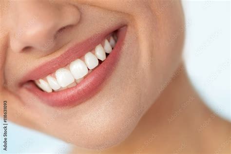 Closeup Of Beautiful Smile With White Teeth. Woman Mouth Smiling. High ...