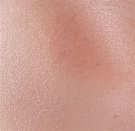 Home | Skinbac Probiotical - Prodotti Probiotici, Simbiotici e Fermenti ...