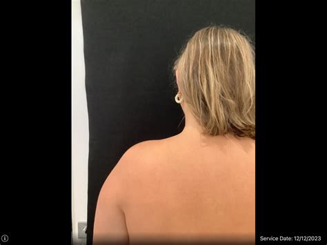 Traptox Review 2024: The Cost, Results, and Side Effects