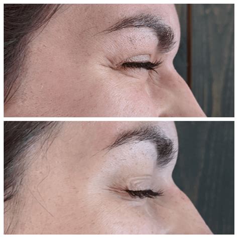 fine line aesthetics llc knoxville photos 1