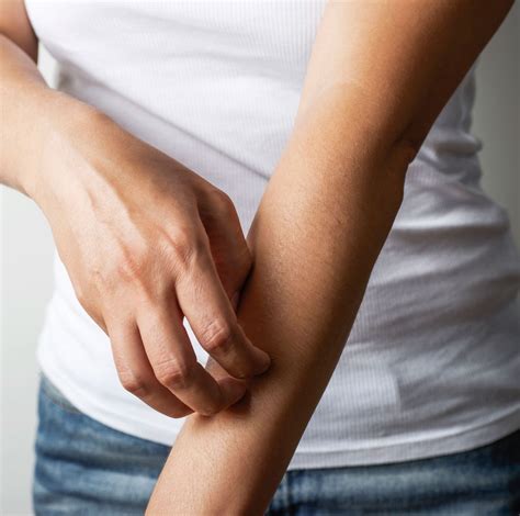 How to truly finally get rid of itchy skin according to dermatologists ...