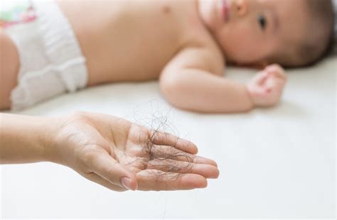 Post-natal Hair Loss - Yun Nam Hair Care