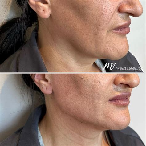 M1 Med Beauty Frankfurt Rezensionen 1