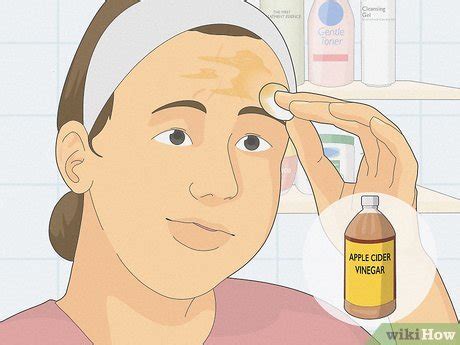 How to Get Rid of the Veins on Your Forehead Naturally