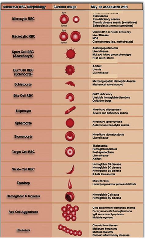 euh morning report   common abnormal red blood cell morpologies