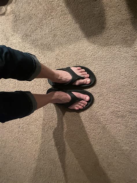 How much was your surgery? : bunions