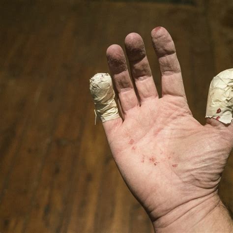 common types  hand injuries harmony lab  safety