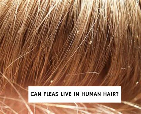 Can Fleas Live in Human Hair?