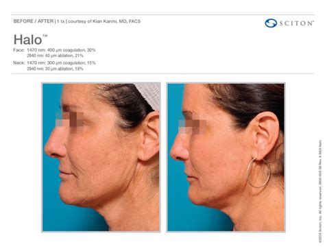 Halo - Plastic Surgery Hub