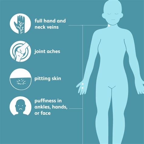 Edema: Symptoms, Causes, Diagnosis, and Treatment