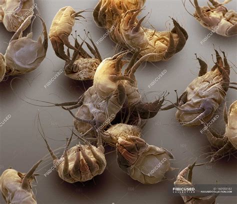 House dust mites — exposure, zoology - Stock Photo | #160555182