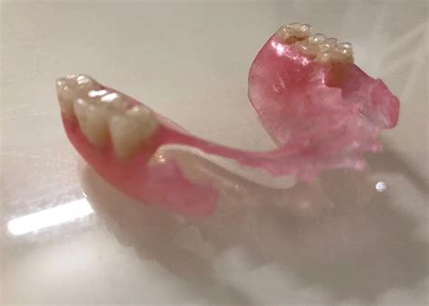 complete denture services  delhi kamal dental clinic