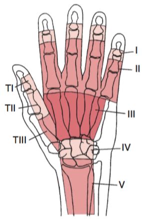 Flexor and extensor tendon injury flashcards